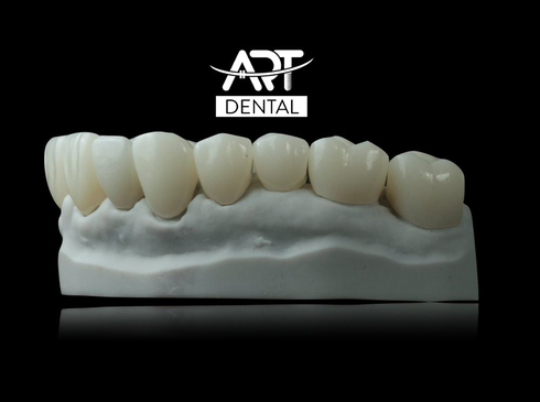 Slider image (7) Art Dental Care